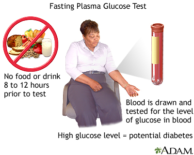 Fasting glucose tolerance test