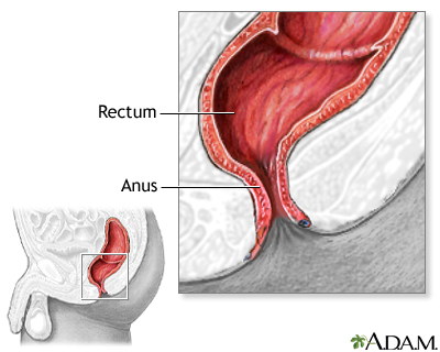 anal reconstruction of hemmoroids Being gay info